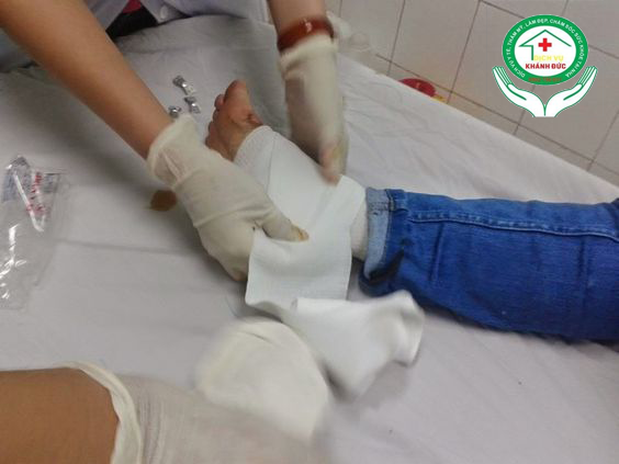Dịch vụ Thay Băng , Cắt chỉ, Rửa Vết Thương Tại Nhà