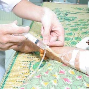  dịch vụ truyền nước tại nhà